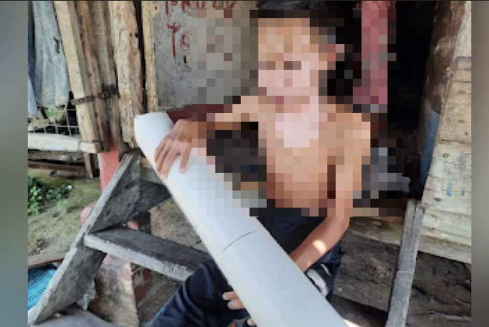 Murid Tahun 6 parah muka dan dada akui serik main mercun buatan sendiri